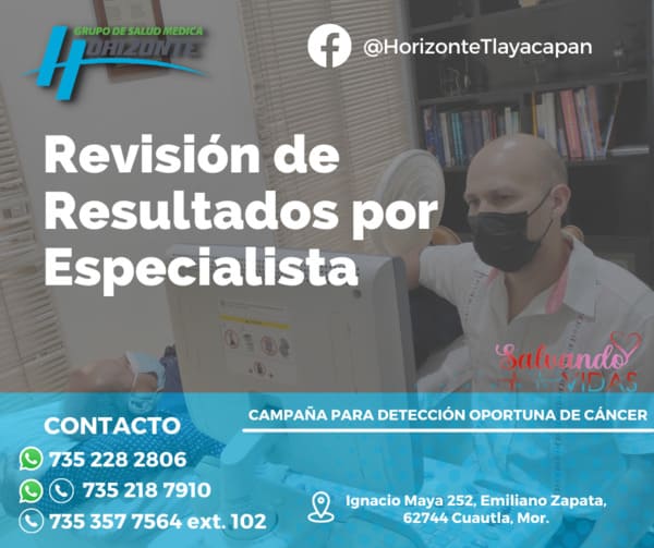 campaña revision de resultados